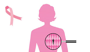 乳がん検診のイメージ